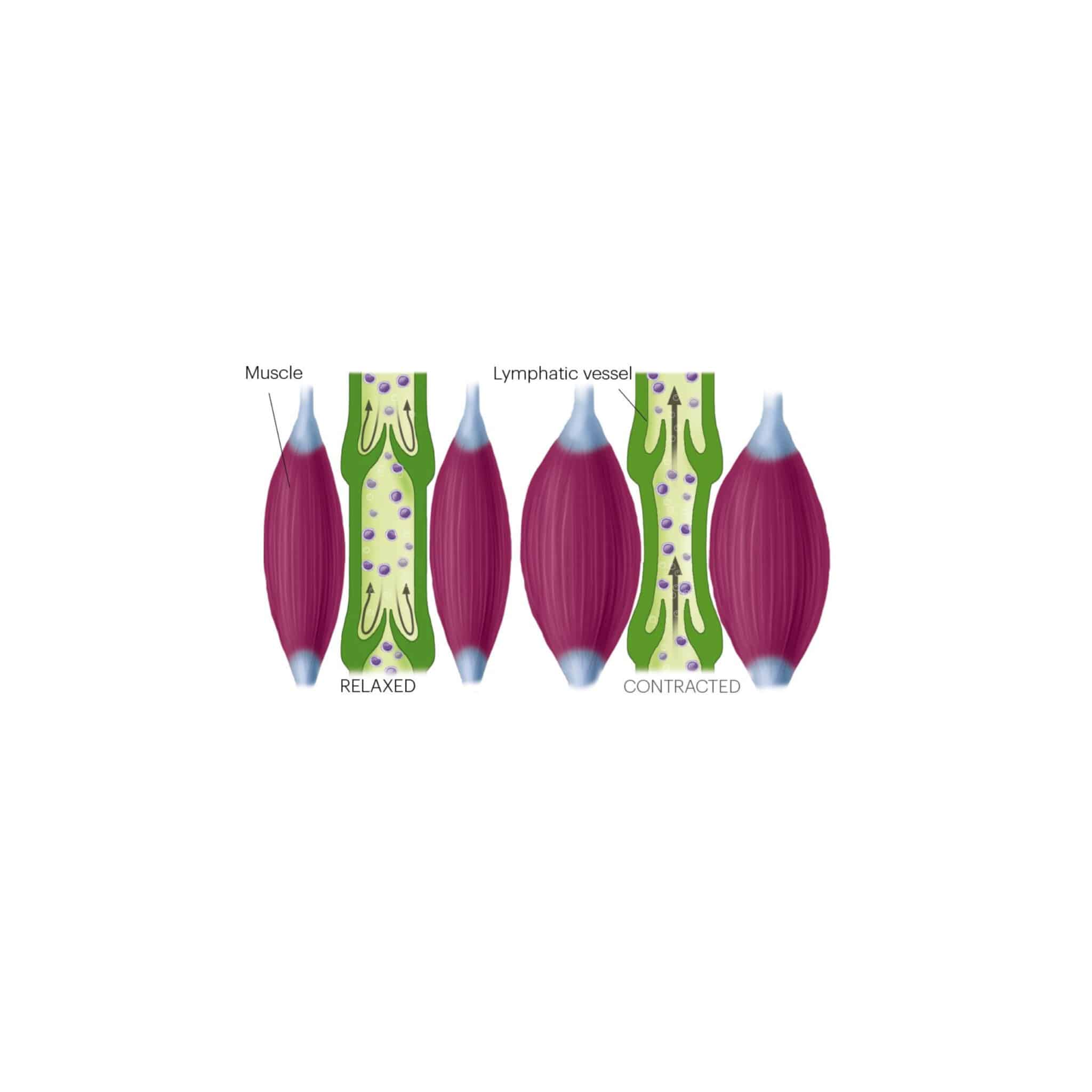 Drawing of how muscles help to pump lymphatic fluid in the lymphatic vessels. Image used under license from Shutterstock.com