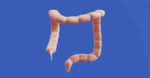 How to prepare for a Colonoscopy