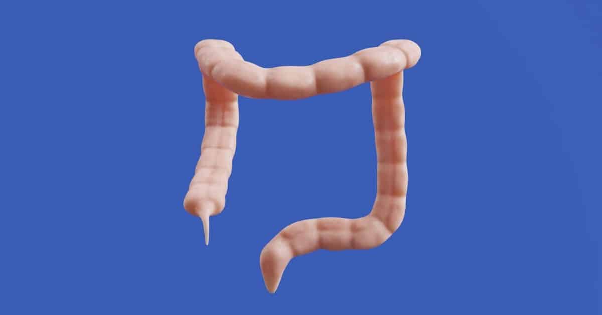 How to prepare for a Colonoscopy
